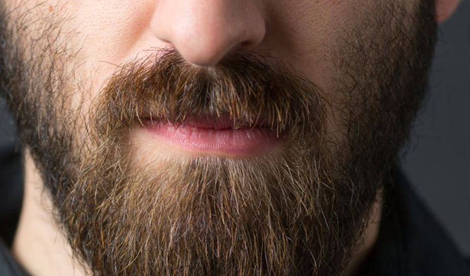 5 Unique Ways for Growing Facial Hair When Having Skin Issues
